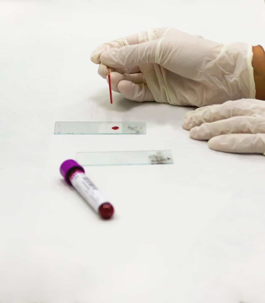 favn test blood testing white gloves